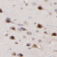 HPA IHC Cerebral cortex — PSMD14