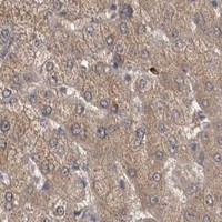 HPA IHC Liver — ATXN2
