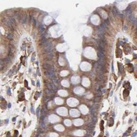 HPA IHC Colon — PFKM