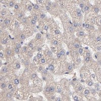 HPA IHC Liver — PFKM