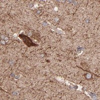 HPA IHC Cerebral cortex — PFKM