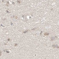 HPA IHC Cerebral cortex — APIP