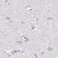 HPA IHC Cerebral cortex — NUB1