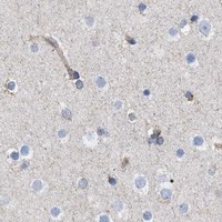 HPA IHC Cerebral cortex — HSD17B4