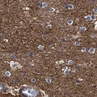 HPA IHC Cerebral cortex — IFT20