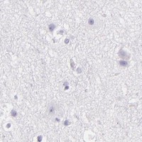 HPA IHC Cerebral cortex — CEACAM1