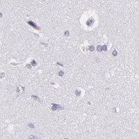 HPA IHC Cerebral cortex — MCM3
