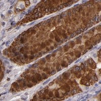 HPA IHC Stomach — TFF1