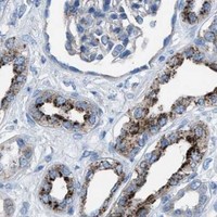 HPA IHC Kidney — CD1B