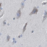 HPA IHC Cerebral cortex — CD1B