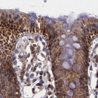 HPA IHC Colon — LONP1