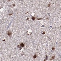 HPA IHC Cerebral cortex — LONP1
