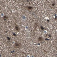 HPA IHC Cerebral cortex — ATXN3