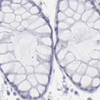HPA IHC Colon — ALDOB