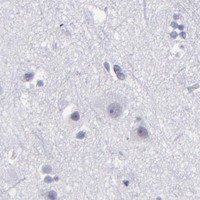 HPA IHC Cerebral cortex — ALDOB
