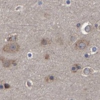 HPA IHC Cerebral cortex — SPAG5