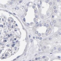 HPA IHC Kidney — CD38
