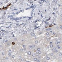 HPA IHC Liver — CD38