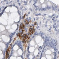 HPA IHC Colon — CD38