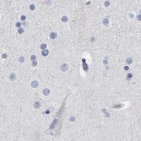 HPA IHC Cerebral cortex — CD38