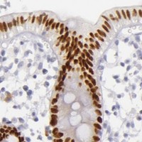HPA IHC Colon — CDX2