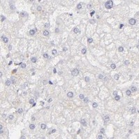 HPA IHC Liver — CDX2