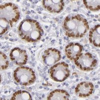 HPA IHC Duodenum — CDX2