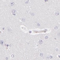 HPA IHC Cerebral cortex — CDX2