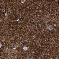 HPA IHC Cerebral cortex — ATP1A2