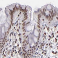 HPA IHC Colon — DAXX