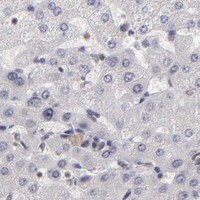 HPA IHC Liver — DAXX