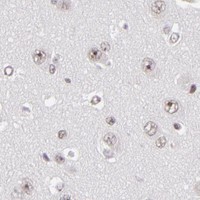 HPA IHC Cerebral cortex — DAXX