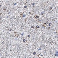 HPA IHC Cerebral cortex — ACADS