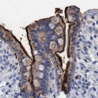 HPA IHC Colon — GRB14