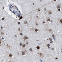 HPA IHC Cerebral cortex — GRB14