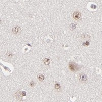 HPA IHC Cerebral cortex — FEN1