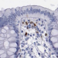 HPA IHC Colon — IRF8