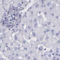 HPA IHC Liver — IRF8