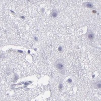 HPA IHC Cerebral cortex — IRF8