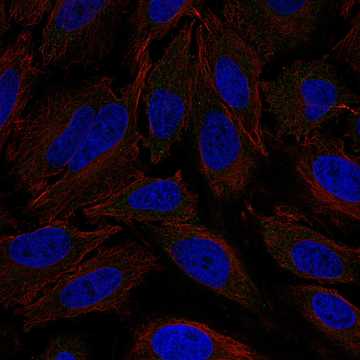 CAB022690: HeLa