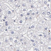 HPA IHC Liver — MGAM