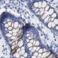HPA IHC Colon — BZW2