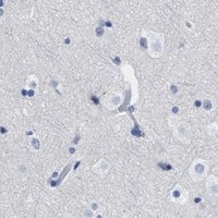 HPA IHC Cerebral cortex — CBX2