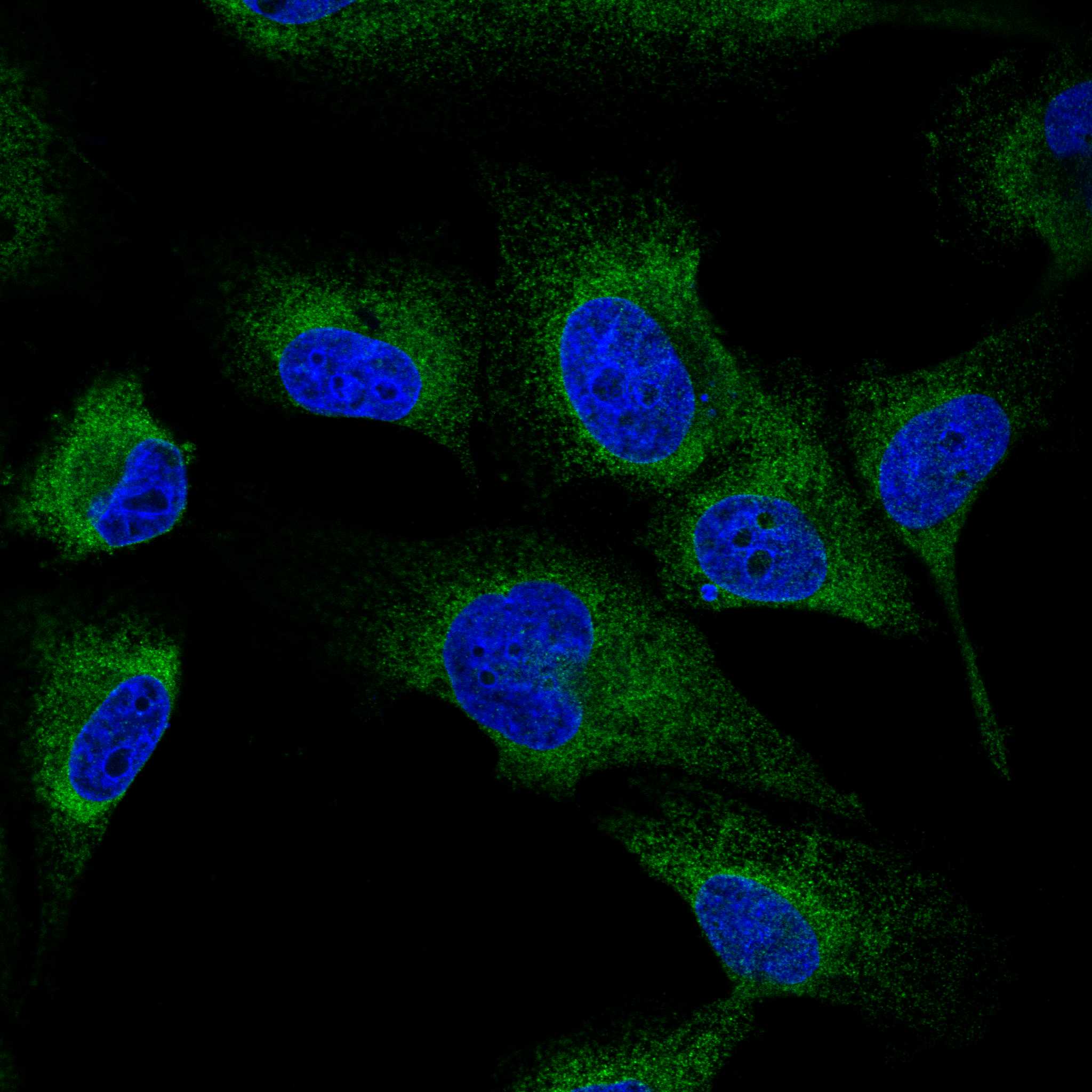 Subcellular ATP2A1 The Human Protein Atlas