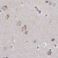 HPA IHC Cerebral cortex — EFEMP2