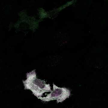 HPA023310: HeLa BAC 6285