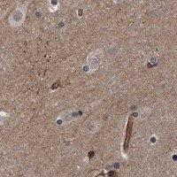 HPA IHC Cerebral cortex — TNFRSF10B