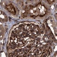 HPA IHC Kidney — TNFRSF10B