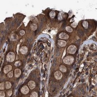 HPA IHC Colon — TNFRSF10B