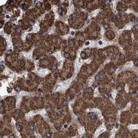 HPA IHC Liver — TNFRSF10B